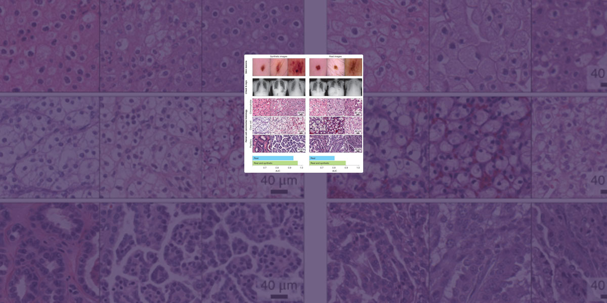 Synthetic data in machine learning for medicine and healthcare - Nature Biomedical Engineering